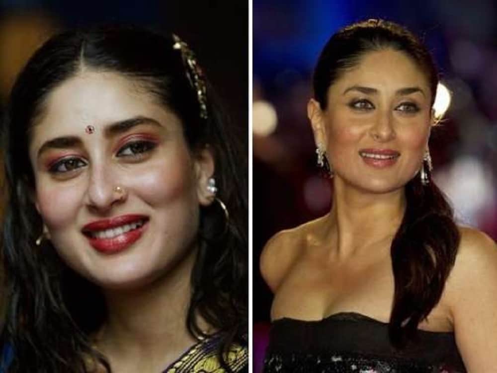 Not only sridevi these five Celebrities also turned Beautiful After Plastic Surgery