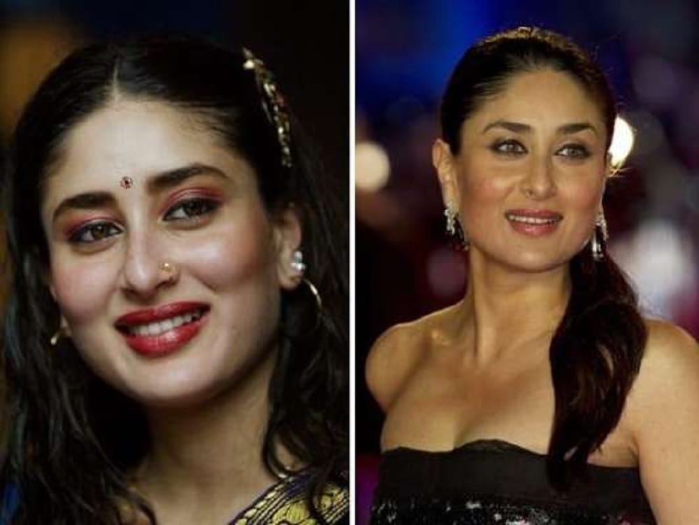 Not only sridevi these five Celebrities also turned Beautiful After Plastic Surgery