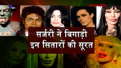 worst plastic surgery