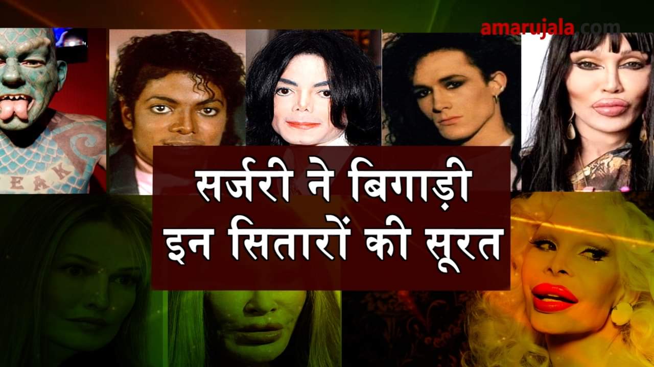 worst plastic surgery