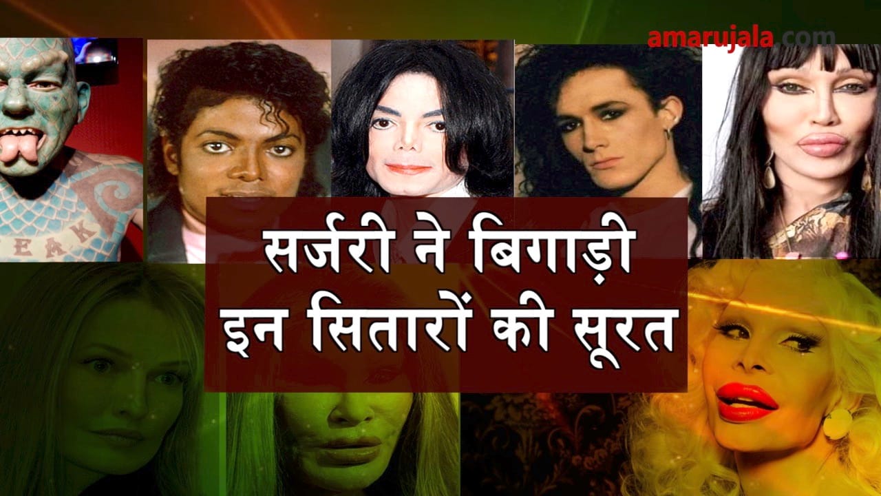 worst plastic surgery