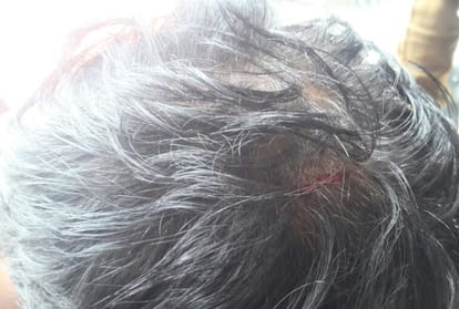 blooded clash between student groups at shimla himachal