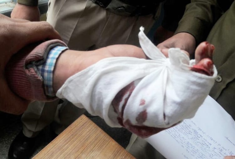 blooded clash between student groups at shimla himachal