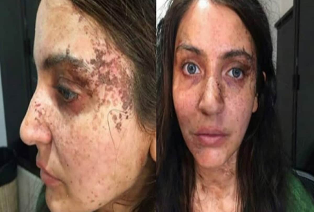 Anushka sharma horrible makeup for the movie pari