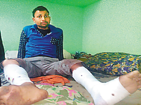 Harsh firing in Tilak, shot on two