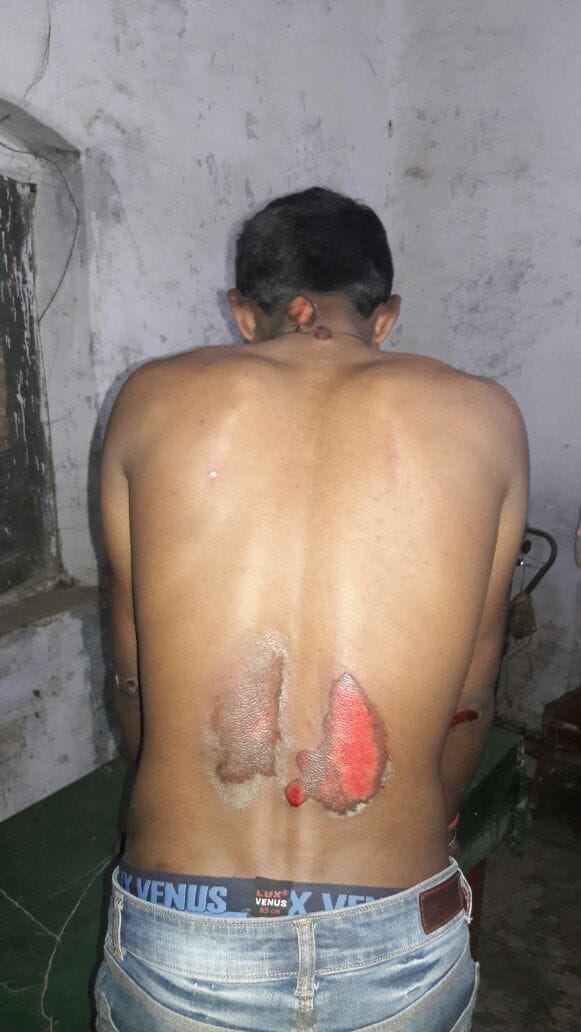 रंजिश में वाहन से कुचलने की कोशिश 