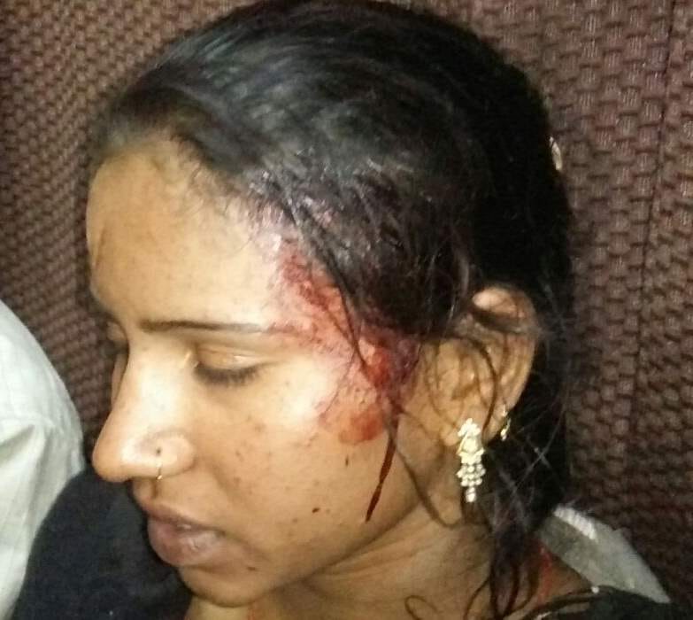 two injured in picketing and firing