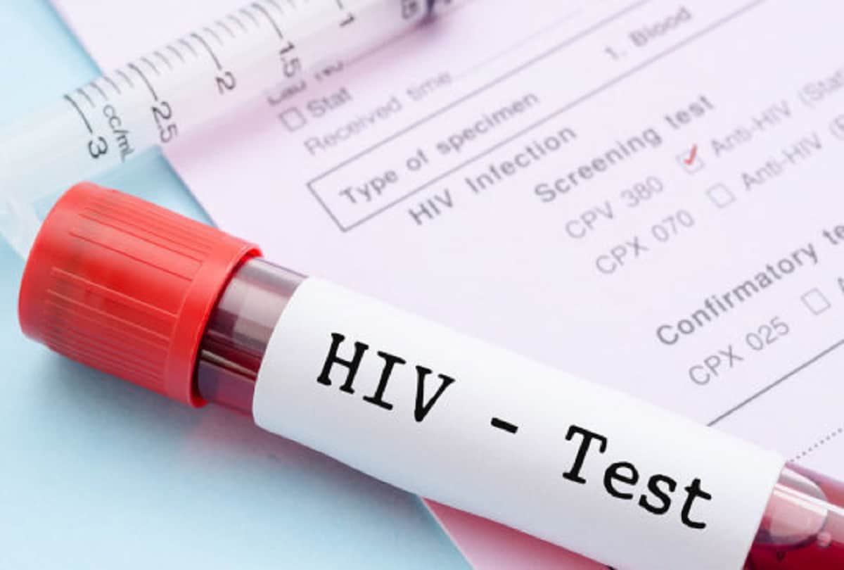 world aids day 2021, know the symptoms and prevention of hiv infection