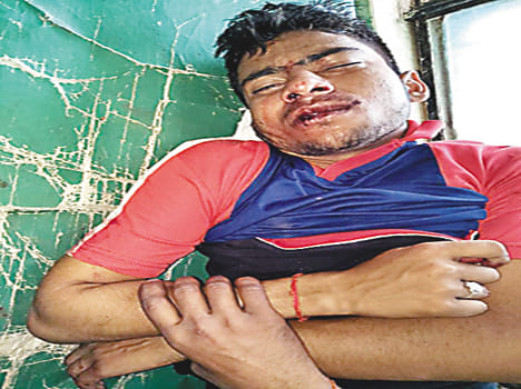 Five injured including assistant Major in bike-scooby clash