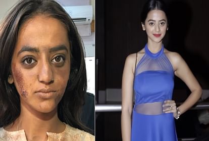 खूबसूरती के चक्कर में बर्बाद हुआ करियर! इन 3 हसीनाओं ने कराया ऐसा मेकओवर कि पहचानना भी हुआ मुश्किल 2 Helly Shah
