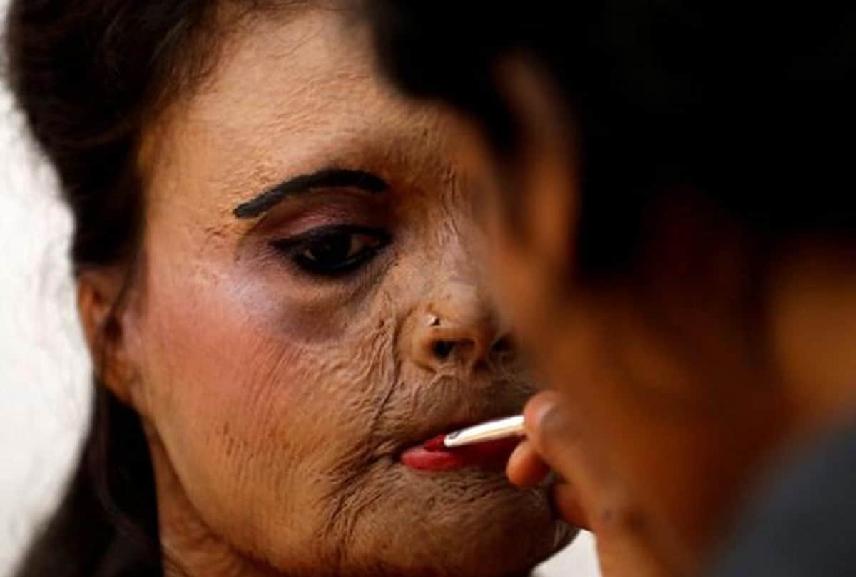 International Women Day 2018 acid attack women fashion show