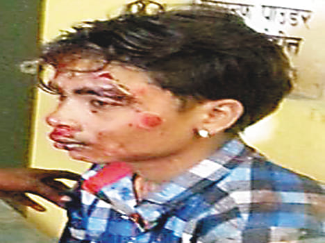 raod accident dies of collision