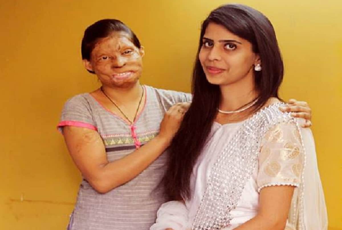 acid attack victim laxmi agarwal chhapaak movie learn how to help them