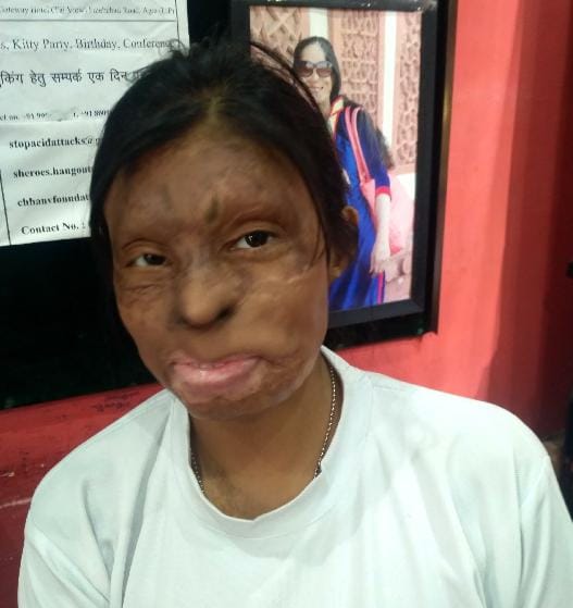acid attack fighter selected for nari shakti award