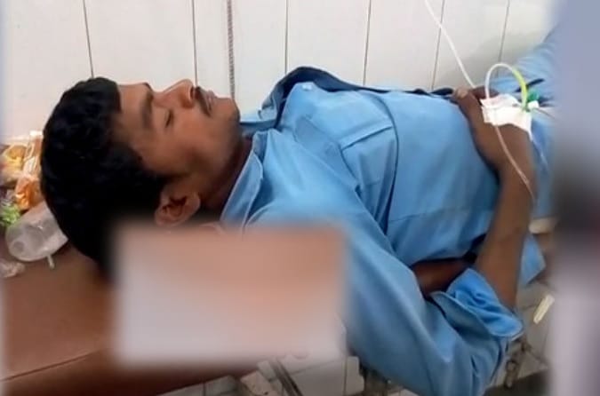 Humiliation done by Doctors in jhansi, put cushion of patient`s leg after cut off