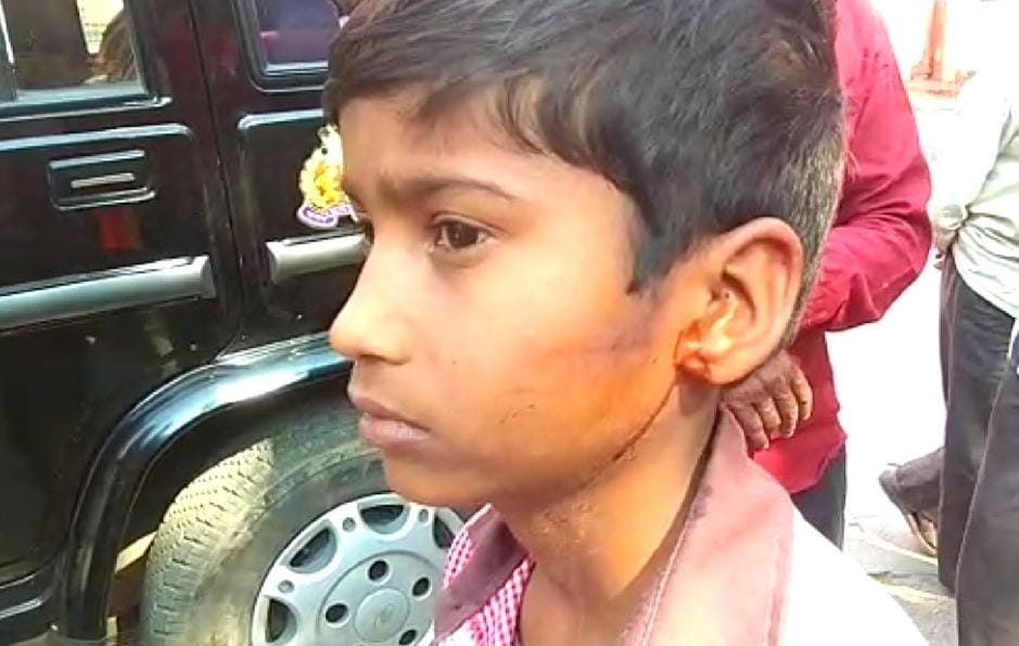 student ear curtain cracked by teacher beating