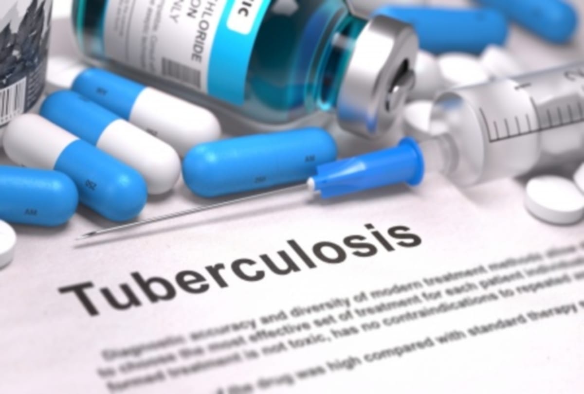 World TB Day 2019 know about TB risk in india symptoms signs and causes