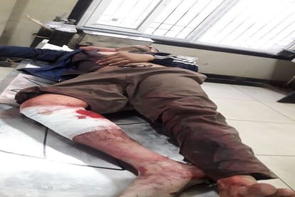 up: Encounter between the police and crooks, shot the accused