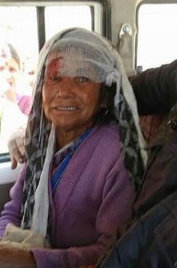 Leopard kills women-, severely injured