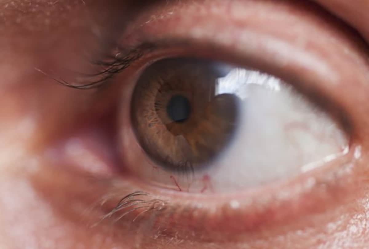 High BP and thyroid can also cause glaucoma