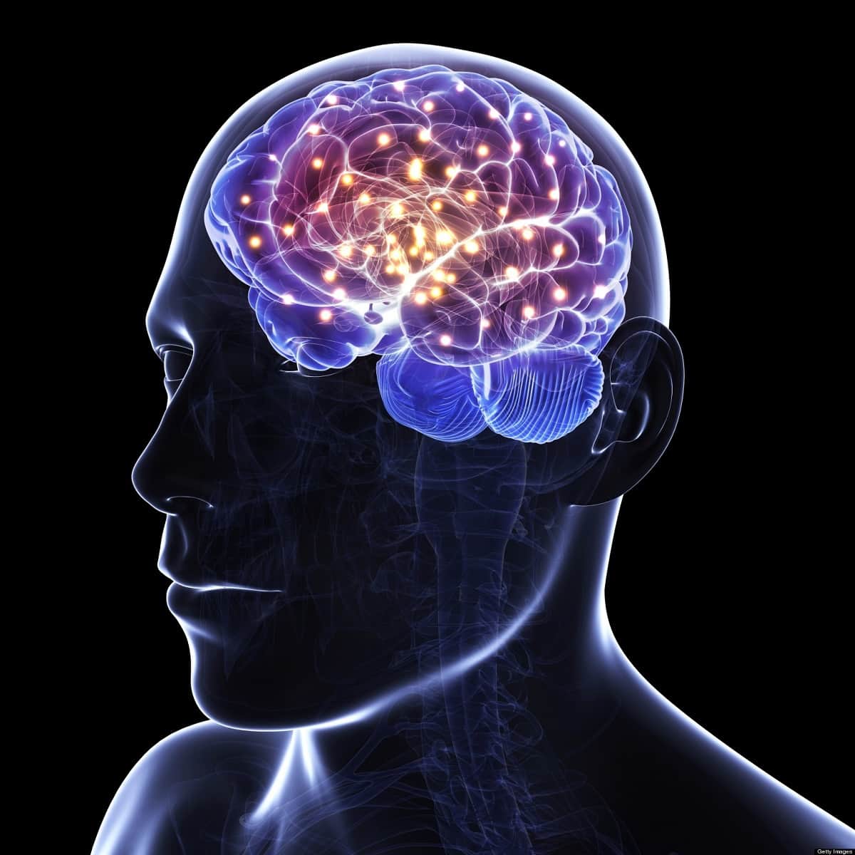 chandigarh Know the causes and symptoms of brain stroke