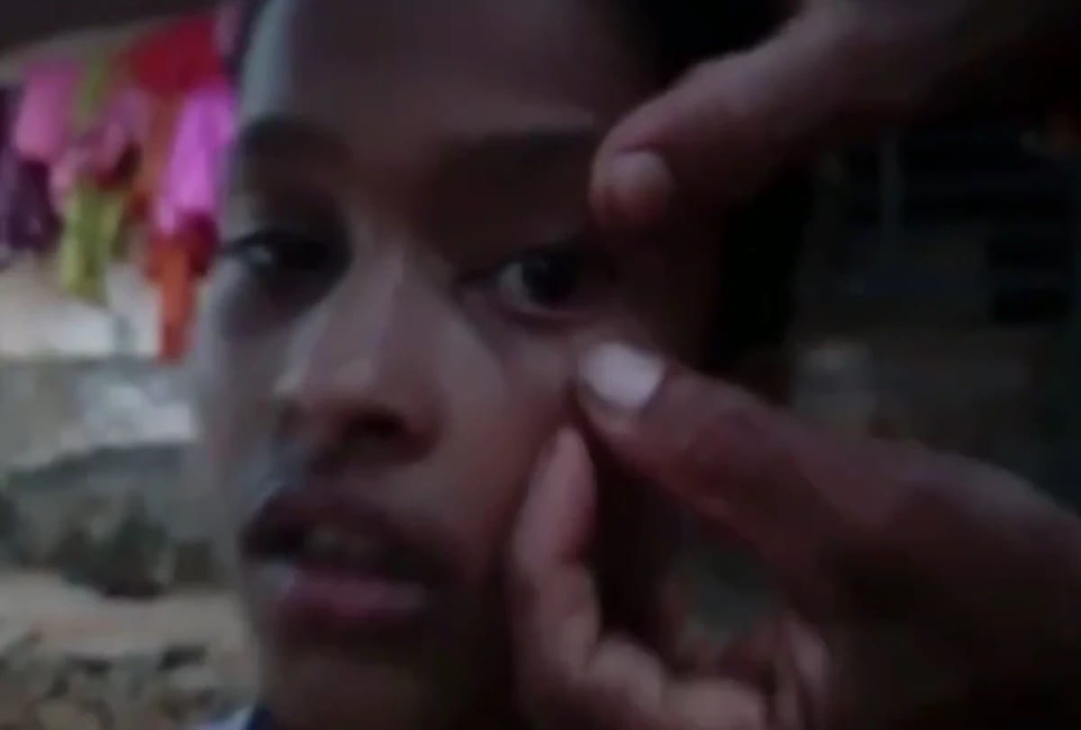 Dead ants found in Kannada girls eyes