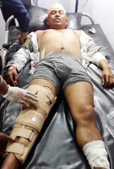 Bullet fired on mayor