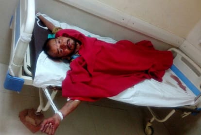 In Noida District Hospital Patient Tied To Bed, Their Beds Are Also