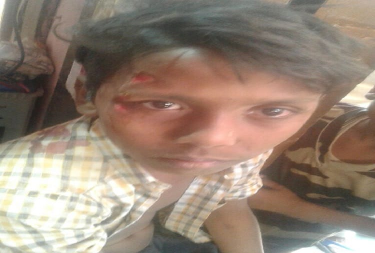 Baghpat's primary school accident, 12 students injured