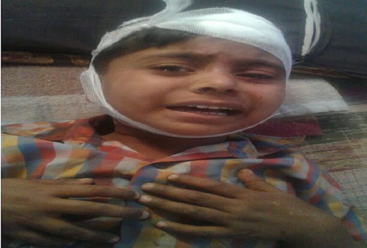Baghpat's primary school accident, 12 students injured