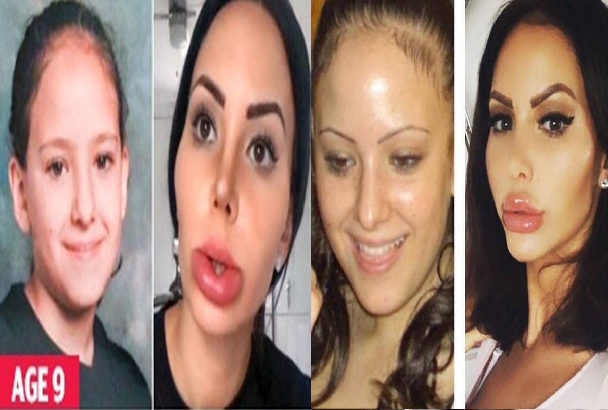 You will be surprised to see this lady who is addicted of plastic surgery