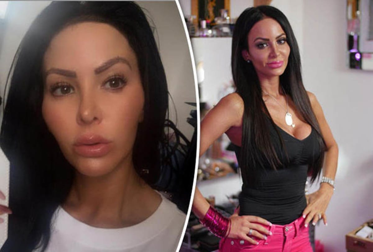 You will be surprised to see this lady who is addicted of plastic surgery