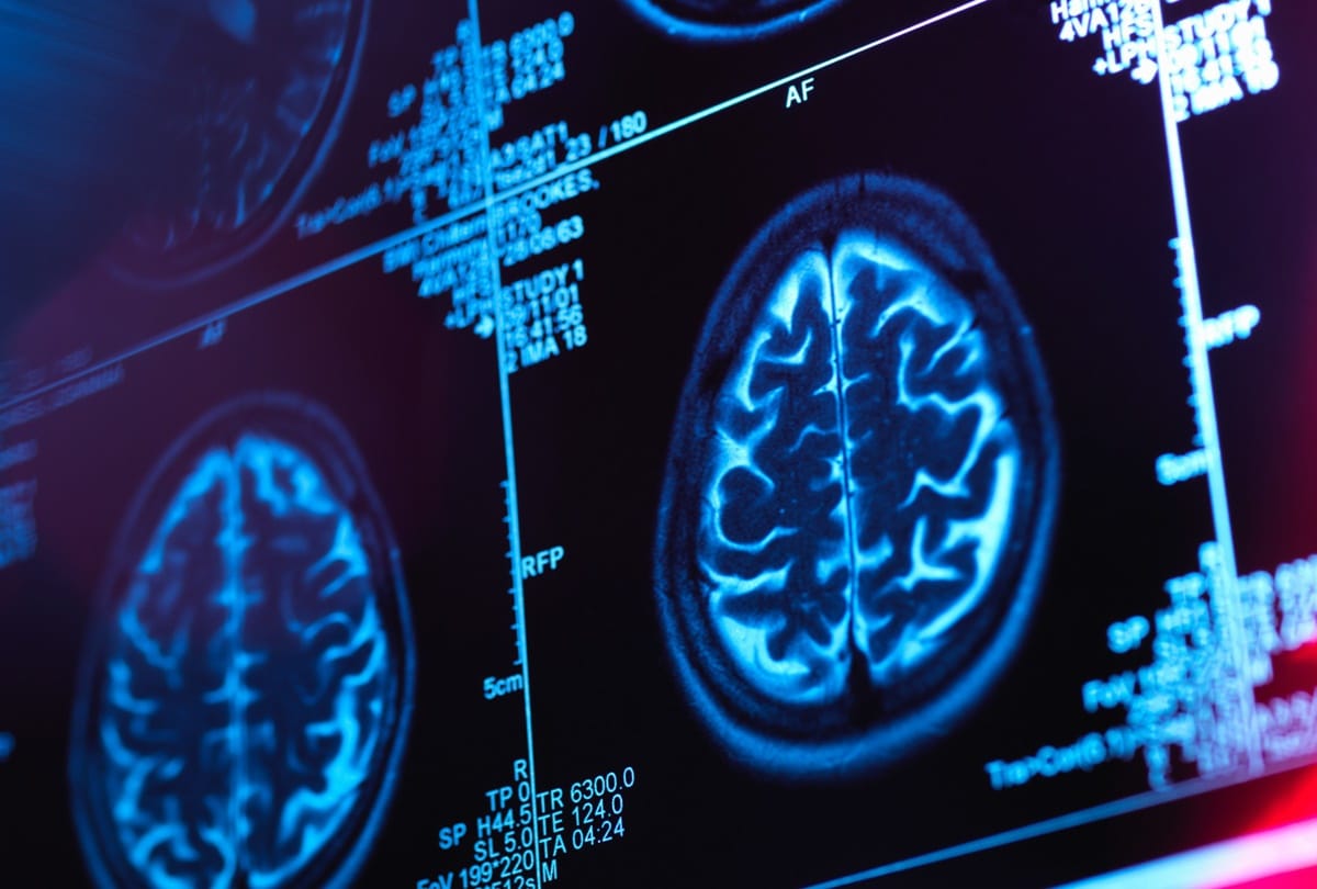 covid-19 is a vascular disease, scientists claim