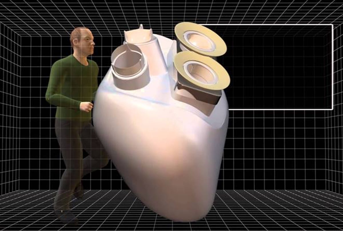 Chinese scientists develops artificial heart with rocket technology