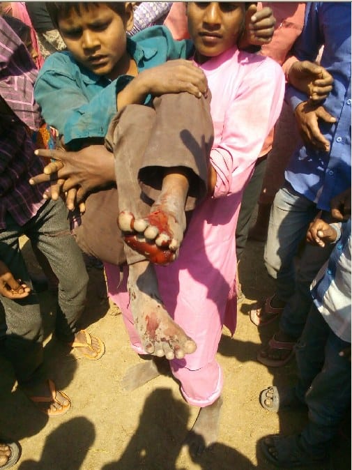 Tigers attacked teenager, injured