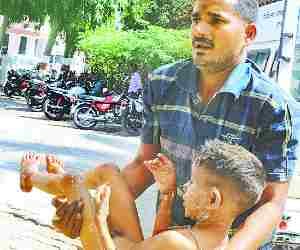 Gas cylinder catches fire, brother-sister burnt