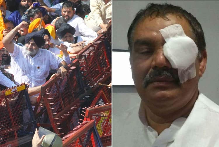 police lathicharge on akali bjp workers in chandigarh, vijay sampla injured