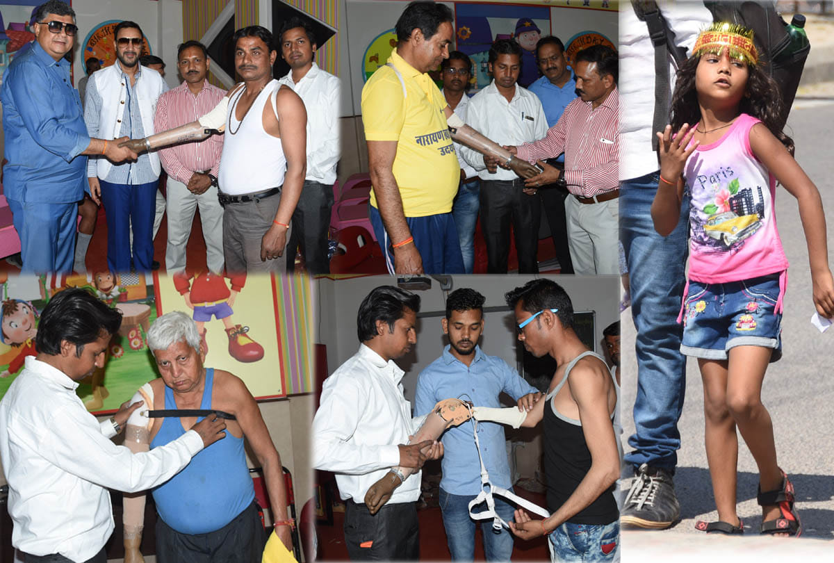 artificial limb distribution camp news