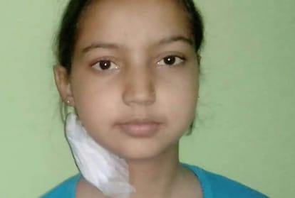 Deepika kidney failure died in PGI Chandigarh