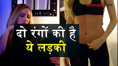 know about chimerism special story