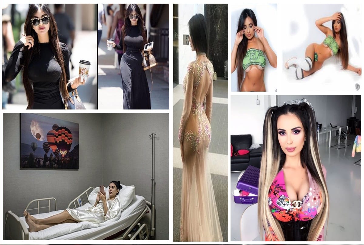 A Girl spends three crore rupees on surgeries to look like hollywood star kim kardashian