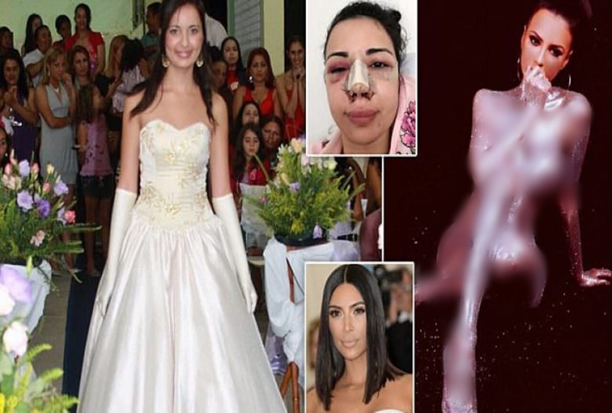 A Girl spends three crore rupees on surgeries to look like hollywood star kim kardashian