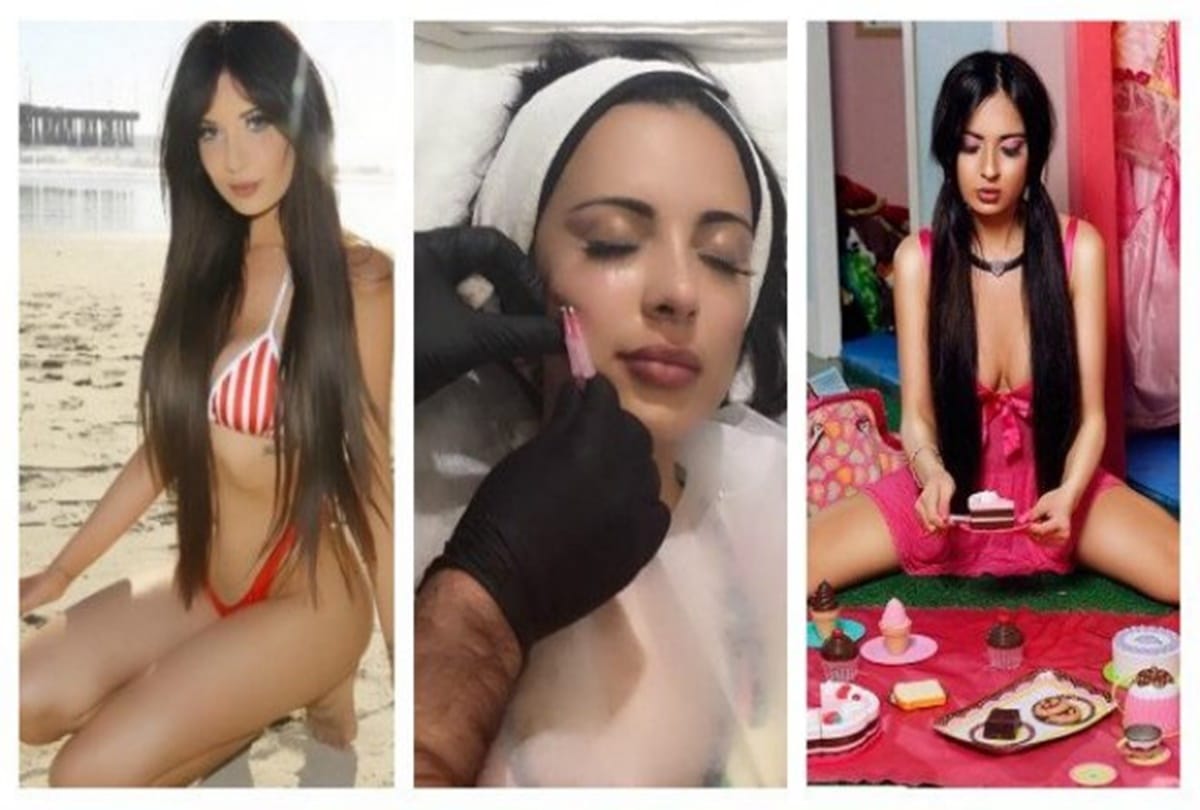 A Girl spends three crore rupees on surgeries to look like hollywood star kim kardashian