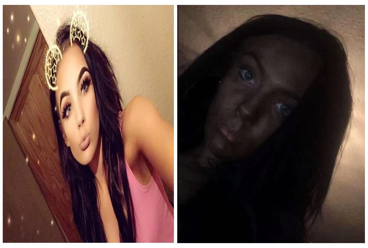 Teen apply a fake Tanning cream on her birthday then she face beauty blunder