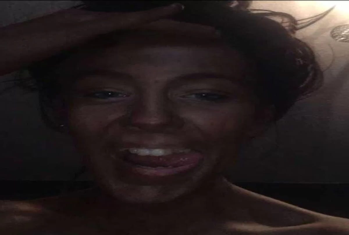 Teen apply a fake Tanning cream on her birthday then she face beauty blunder