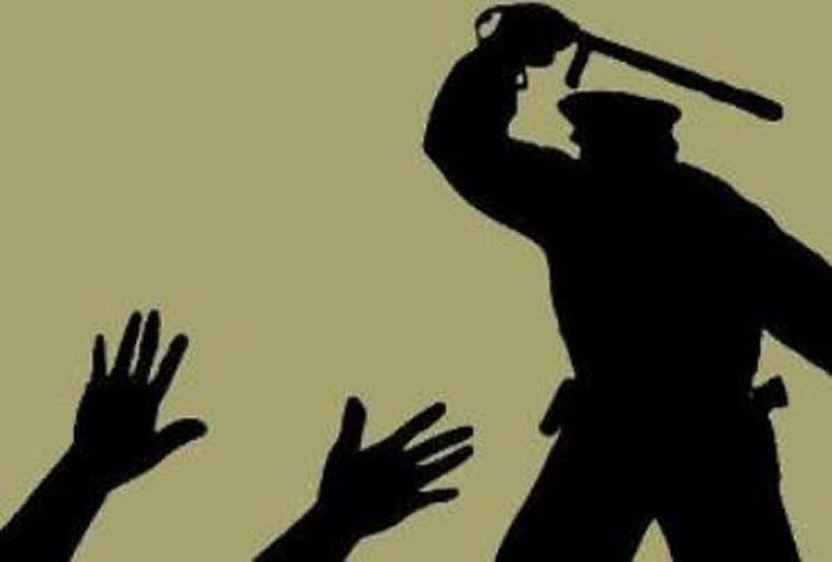 up police Physical harassment