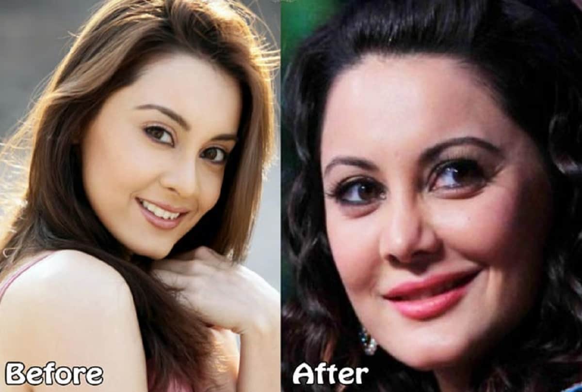 7 Popular Bollywood Actresses who gone through Plastic surgery on face