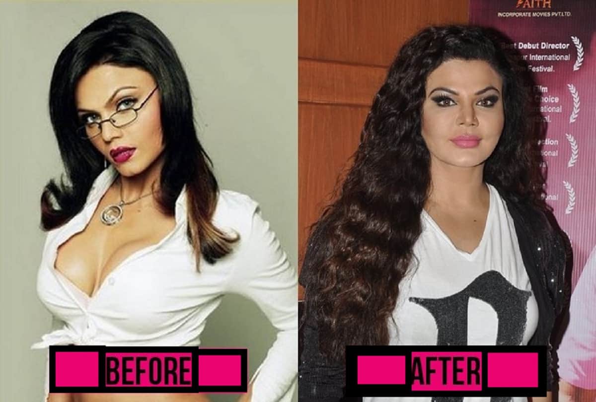 Rakhi sawant Birthday Special She gets Films After Surgery