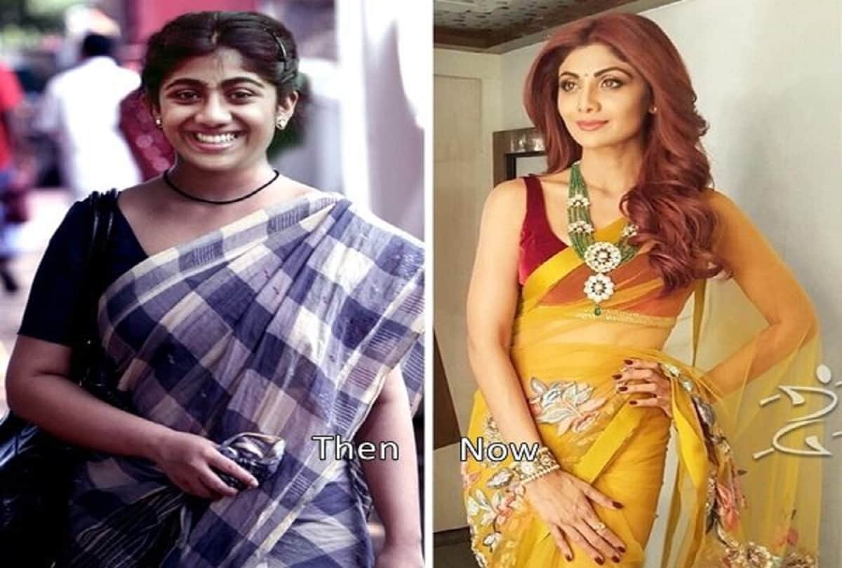 7 Popular Bollywood Actresses who gone through Plastic surgery on face