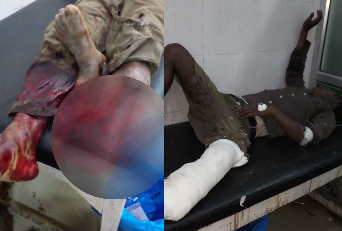 carelessness of doctors in district hospital sultanpur